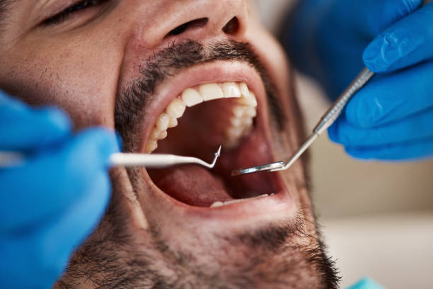Fast & Reliable Emergency Dental Services in WI